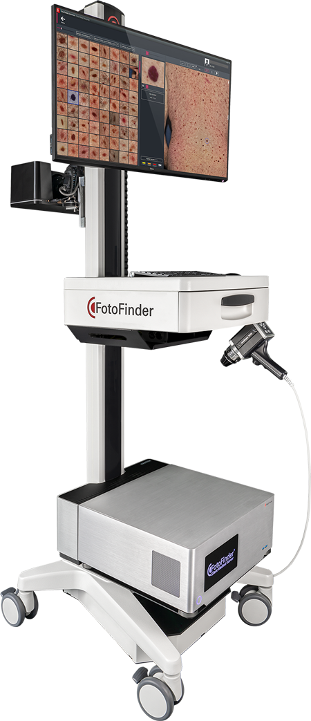 Fotofinder Front